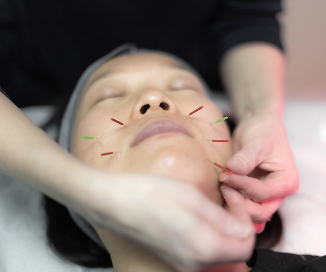 Cosmetic Acupuncture